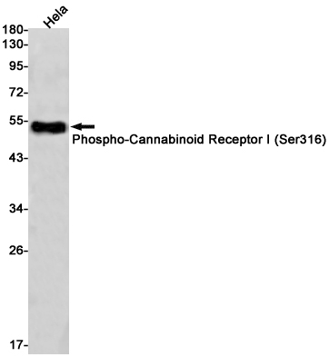 Phospho-Cannabinoid Receptor I (Ser316) Rabbit mAb